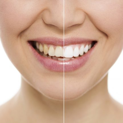 Top Cosmetic Dentistry Procedures | Tower House Dental Clinic